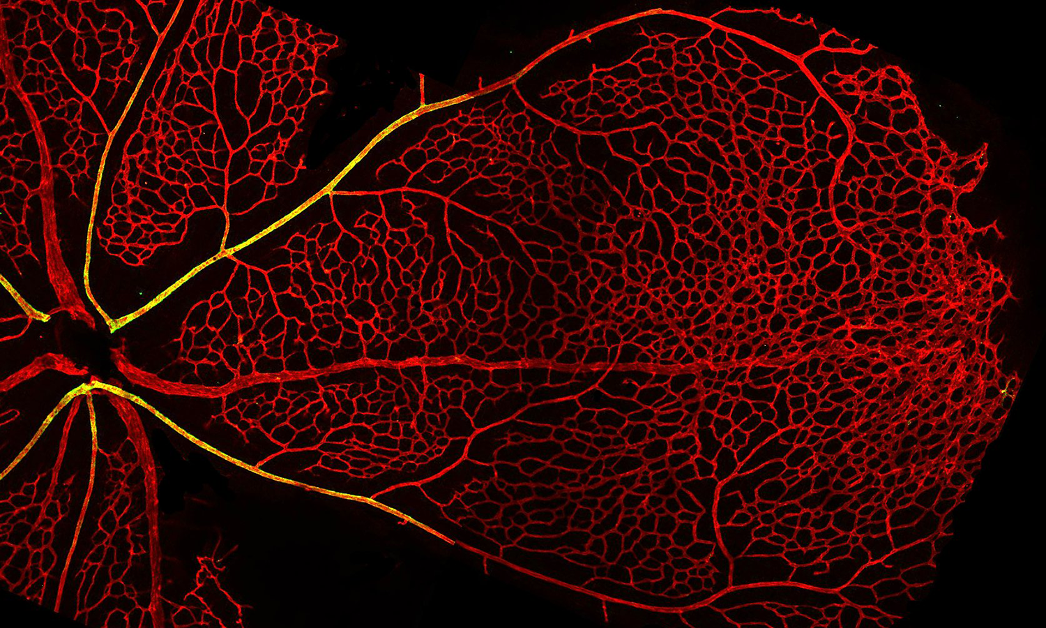 Neonatal Mouse Retina Vasculature