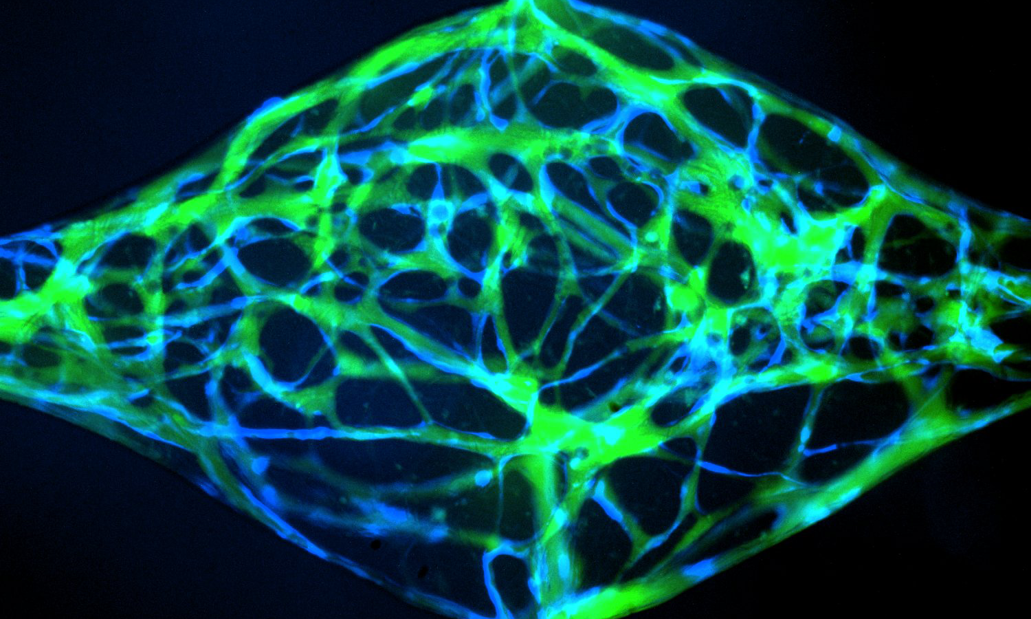 Perfused Microvessels-on-a-chip